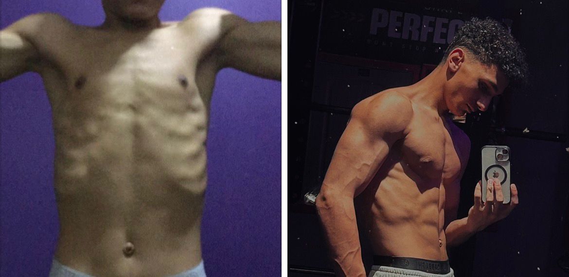 Champion Transformation